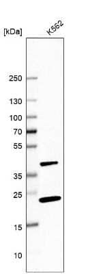 Western Blot: PINX1 Antibody [NBP1-83643]