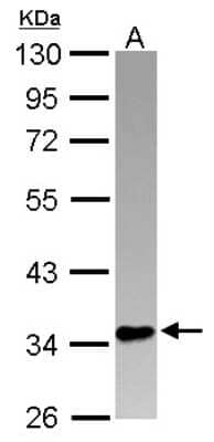 Western Blot: PINX1 Antibody [NBP2-19832]