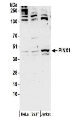 Western Blot: PINX1 Antibody [NBP2-32265]