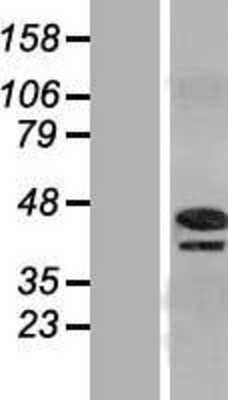 Western Blot: PINX1 Overexpression Lysate [NBL1-14430]