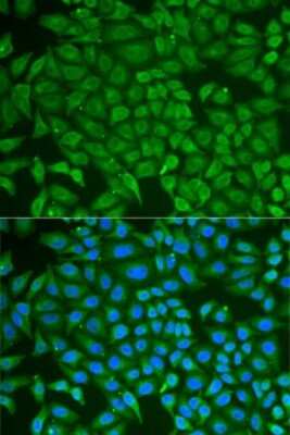 Immunocytochemistry/ Immunofluorescence: PIP Antibody - BSA Free [NBP2-93942]