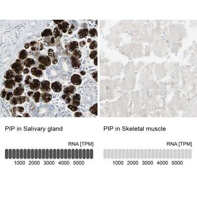 Immunohistochemistry-Paraffin: PIP Antibody [NBP1-83386]