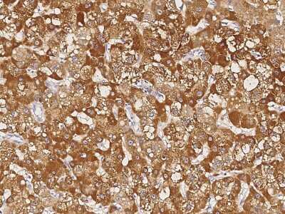 Immunohistochemistry-Paraffin: PIP Antibody [NBP2-98684]