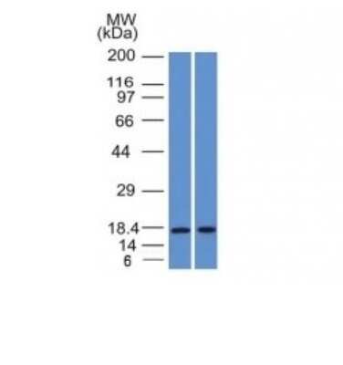 Western Blot: PIP Antibody (PIP/1571) [NBP2-53226]