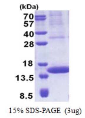 SDS-PAGE: Recombinant Human PIP His Protein [NBP2-23366]