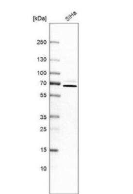 Western Blot: PIP5K1 alpha Antibody [NBP1-90358]