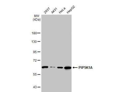 Western Blot: PIP5K1 alpha Antibody [NBP2-19833]