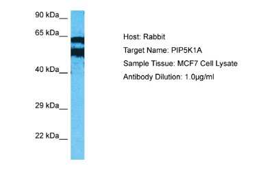 Western Blot: PIP5K1 alpha Antibody [NBP2-88052]