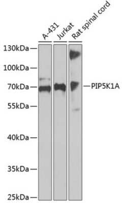 Western Blot: PIP5K1 alpha AntibodyBSA Free [NBP2-93251]