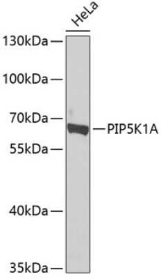 Western Blot: PIP5K1 alpha AntibodyBSA Free [NBP2-93642]