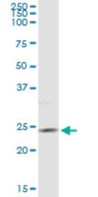 Immunoprecipitation: PIP5K1C Antibody (2E9) [H00023396-M02]