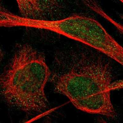 Immunocytochemistry/ Immunofluorescence: PIP5K1C Antibody [NBP1-82986]