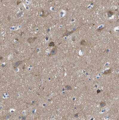 Immunohistochemistry-Paraffin: PIP5K1C Antibody [NBP1-82986]
