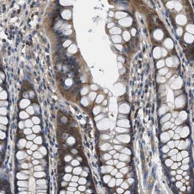 Immunohistochemistry-Paraffin: PIP5K1C Antibody [NBP1-82986]
