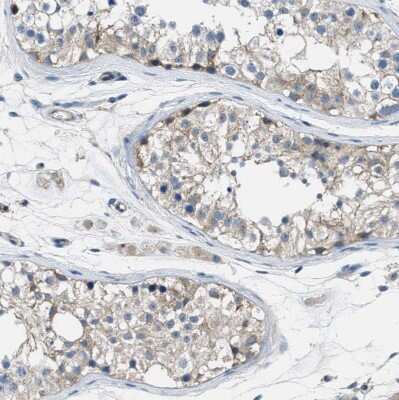 Immunohistochemistry-Paraffin: PIP5K1C Antibody [NBP1-82986]