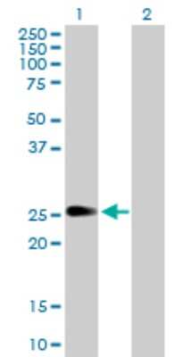 Western Blot: PIP5K1C Antibody [H00023396-D01P]