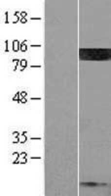 Western Blot: PIP5K1C Overexpression Lysate [NBL1-14436]