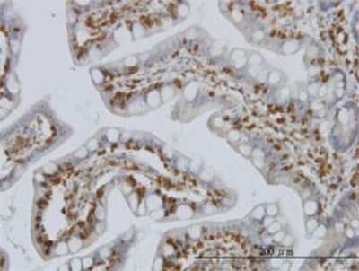 Immunohistochemistry-Paraffin: PIP5K2 alpha Antibody (3A3) [H00005305-M01]