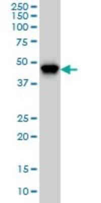 Western Blot: PIP5K2 alpha Antibody (3A3) [H00005305-M01]