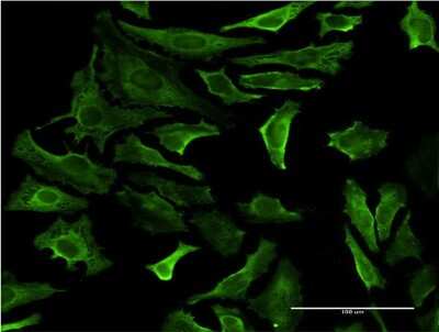 Immunocytochemistry/ Immunofluorescence: PIP5K2 alpha Antibody (3H5) [H00005305-M08]