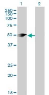 Western Blot: PIP5K2 alpha Antibody (3H5) [H00005305-M08]