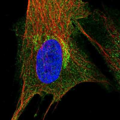 Immunocytochemistry/ Immunofluorescence: PIP5K2 alpha Antibody [NBP2-56952]