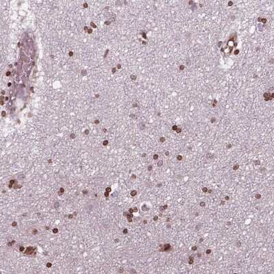 Immunohistochemistry: PIP5K2 alpha Antibody [NBP2-49566]