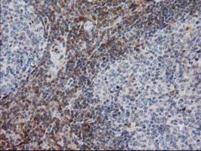 Immunohistochemistry: PIP5K2 alpha Antibody (OTI3D3) - Azide and BSA Free [NBP2-73417]