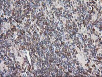 Immunohistochemistry: PIP5K2 alpha Antibody (OTI3D3) - Azide and BSA Free [NBP2-73417]