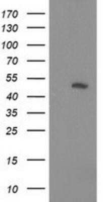 Western Blot: PIP5K2 alpha Antibody (OTI3D3)Azide and BSA Free [NBP2-73417]