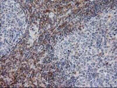 Immunohistochemistry-Paraffin: PIP5K2 alpha Antibody (OTI3D3) [NBP2-03492]