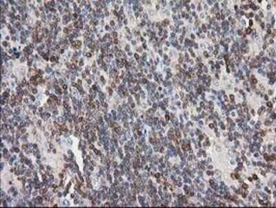 Immunohistochemistry-Paraffin: PIP5K2 alpha Antibody (OTI3D3) [NBP2-03492]