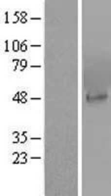 Western Blot: PIP5K2 alpha Overexpression Lysate [NBL1-14432]