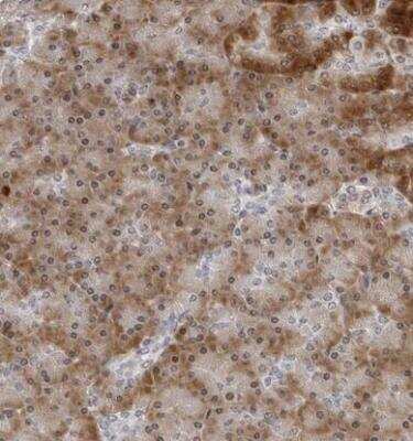 Immunohistochemistry-Paraffin: PIP5K2 gamma Antibody [NBP1-92272]