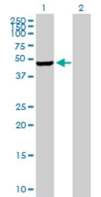 Western Blot: PIP5K2 gamma Antibody [H00079837-B01P]