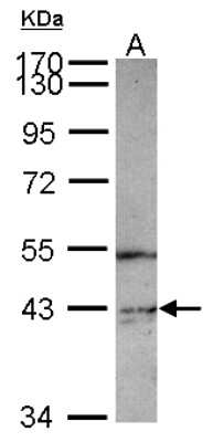 Western Blot: PIP5K2 gamma Antibody [NBP2-19836]