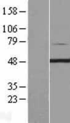 Western Blot: PIP5K2 gamma Overexpression Lysate [NBL1-14433]