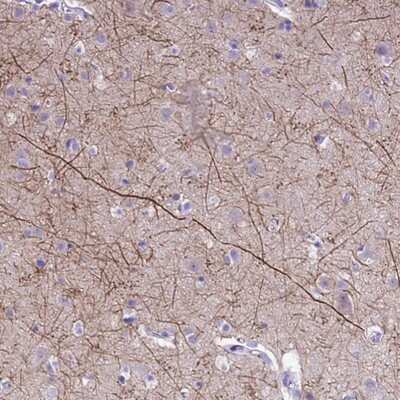 Immunohistochemistry-Paraffin: PIP5K2B Antibody [NBP2-13764]