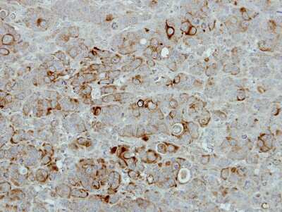 Immunohistochemistry-Paraffin: PIP5K2B Antibody [NBP2-19837]