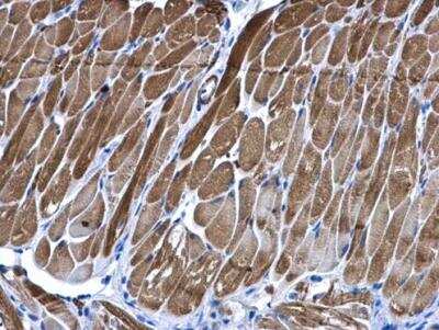 Immunohistochemistry-Paraffin: PIP5K2B Antibody [NBP2-19837]