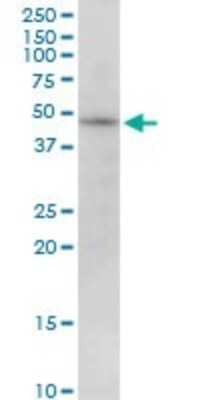 Western Blot: PIP5K2B Antibody [H00008396-B01P]