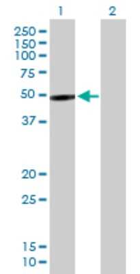 Western Blot: PIP5K2B Antibody [H00008396-B01P]