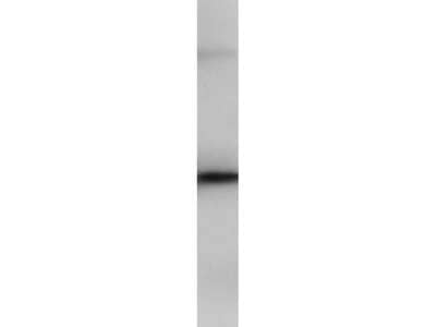 Western Blot: PIP5K2B Antibody [NBP1-44261]