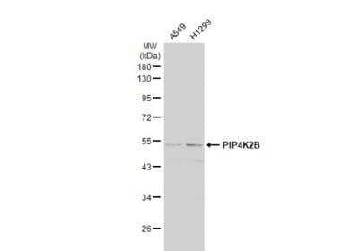 Western Blot: PIP5K2B Antibody [NBP2-19837]