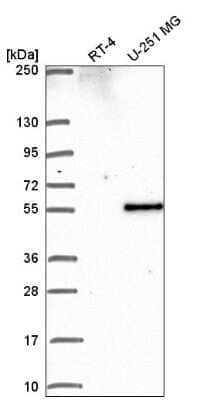 Western Blot: PIP5K2B Antibody [NBP2-56946]