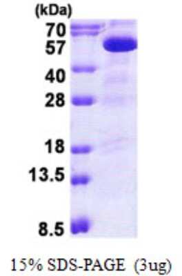 SDS-PAGE: Recombinant Human PIP5K2B His Protein [NBP2-23327]