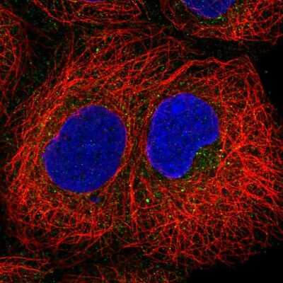 Immunocytochemistry/ Immunofluorescence: PIP5KL1 Antibody [NBP2-33779]