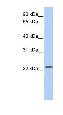 Western Blot: PIP5KL1 Antibody [NBP1-52922]