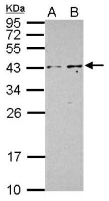 Western Blot: PIP5KL1 Antibody [NBP2-19838]