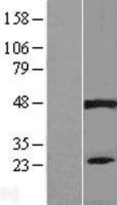 Western Blot: PIP5KL1 Overexpression Lysate [NBL1-14437]